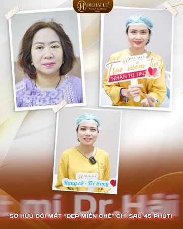 Mọi thứ đều có thể nếu niềm tin đặt đúng chỗ: Chỉ 45 PHÚT nếp mí đã sắc nét, đẹp mọi góc nhìn - Cắt mí ngay hôm nay tại Dr.Hải Lê!