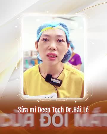 Chỉ với 1 giờ 30 phút cùng tay nghề Bác sĩ giàu kinh nghiệm, tình trạng mí hỏng từ nhẹ đến nặng đều có thể được cải thiện!