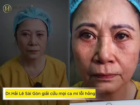 "3 năm sống chung với đôi mắt lỗi hỏng là 3 năm tôi trầm cảm, tự ti và mọi kế hoạch công việc làm ăn của tôi cũng từ đó sụt giảm..."