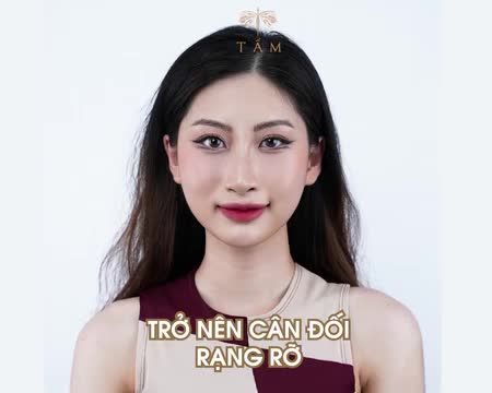 Bạn từng không hài lòng vì khuôn mặt hốc hác, thiếu sức sống? Bạn ngại giao tiếp trước ống kính?
