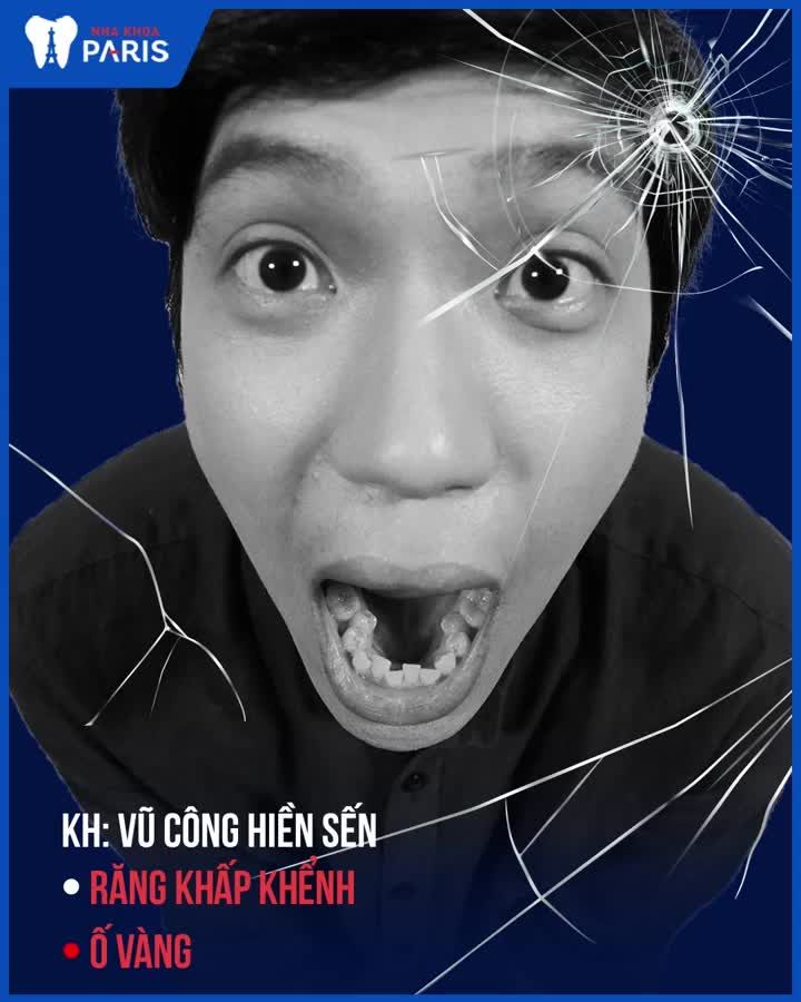 TẠM BIỆT RĂNG Ố VÀNG, KHẤP KHỂNH