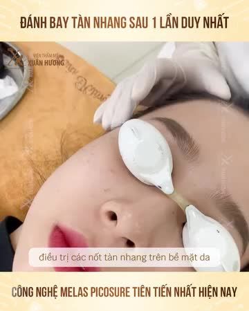 BẠN CÓ TIN SAU 1 BUỔI ĐIỀU TRỊ DUY NHẤT, TÀN NHANG SẼ BIẾN MẤT