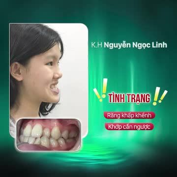 TỪ NGÀY HÔM NAY EM ĐÃ CÓ THỂ TỰ TIN VỚI NỤ CƯỜI CỦA CHÍNH MÌNH