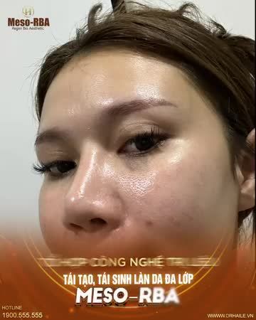 Hiệu quả khác biệt chỉ sau 60 phút thực hiện với chi phí vô cùng tiết kiệm!