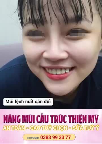 NÂNG MŨI CẤU TRÚC - TẠO FORM MŨI CAO THON, MỀM MẠI, TỰ NHIÊN