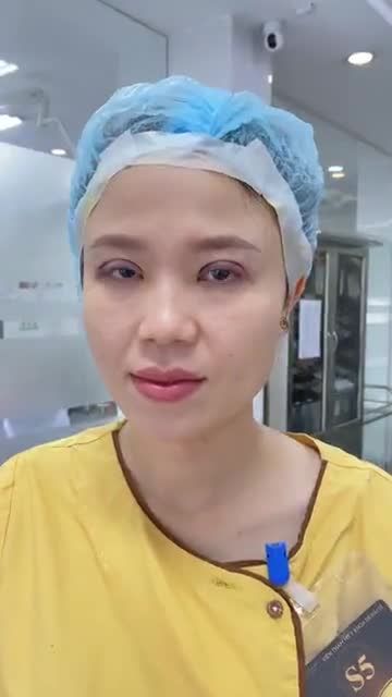 Nếp mí vừa thực hiện xong đẹp xuất sắc ekip khoe luôn cho cả nhà cùng ngắm đây ạ