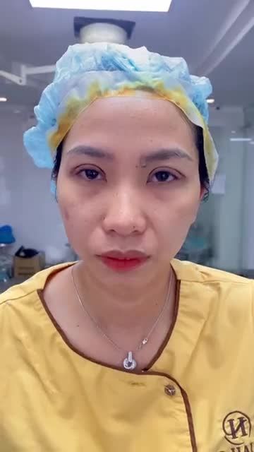 Mắt to mắt nhỏ được Dr.Hải Lê Sài Gòn chỉnh hình thành công như thế nào
