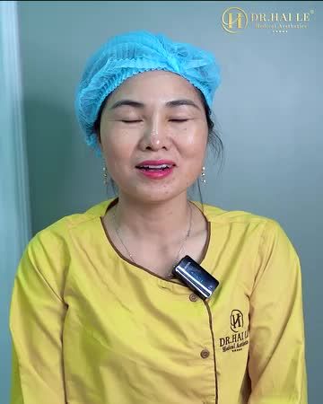 Từng thực hiện cắt mí tại cơ sở thẩm mỹ kém uy tín, kết quả chị Hoa nhận được là đôi mắt "bồ câu con đậu, con bay" khác xa so với tưởng tượng...