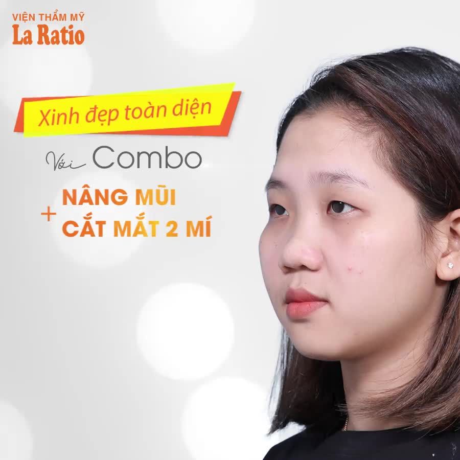 XINH ĐẸP TOÀN DIỆN VỚI COMBO NÂNG MŨI + CẮT MẮT 2 MÍ