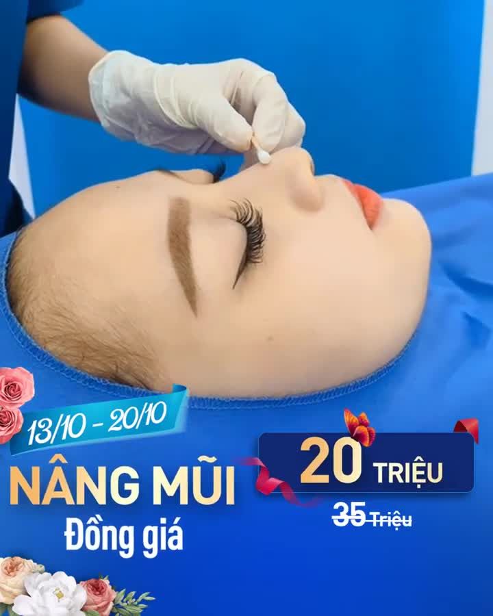 NÂNG MŨI ĐỒNG GIÁ! Còn 20 TRIỆU (Giá gốc: 35 triệu)