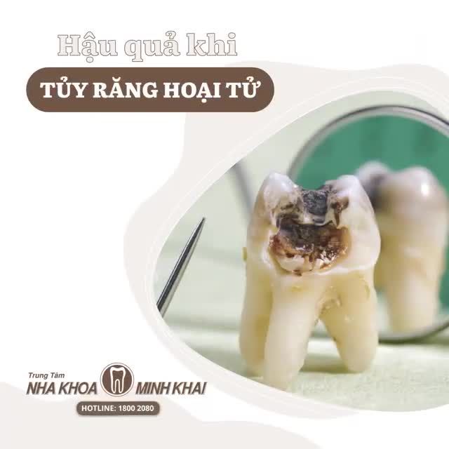Đừng thấy hoa nở mà tưởng xuân về  Đừng thấy răng hết đau mà nghĩ đã ổn