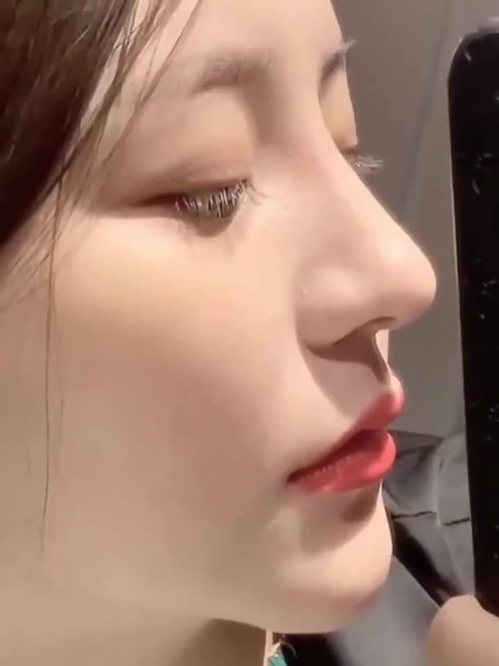 FEEDBACK khách hàng sau 3 tháng nâng mũi Bella Silk 5S tại Viện thẩm mỹ Hà Nội.