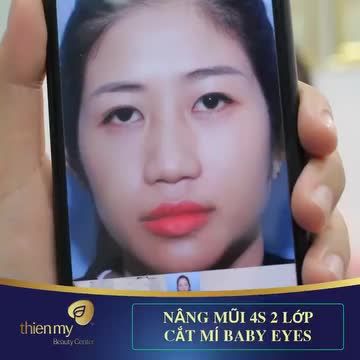 Tạo hình mắt 2 mí Baby Eyes - Đôi mắt to tròn, long lan