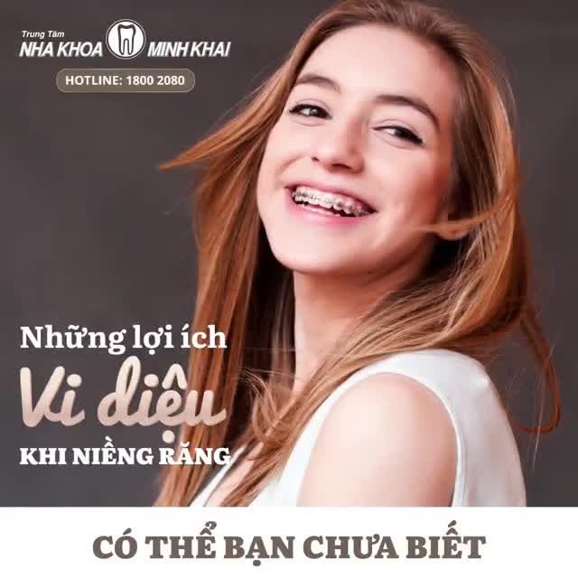 Những lợi ích “vi diệu” khi niềng răng