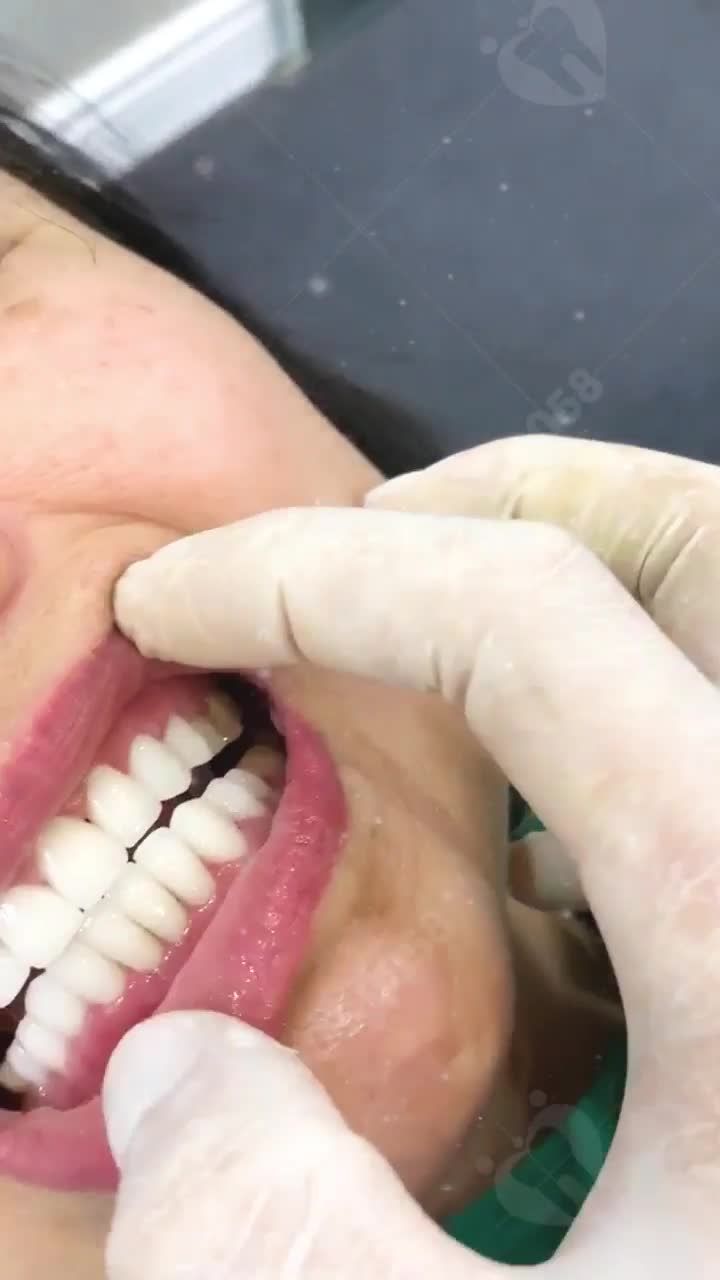 RĂNG ĐẸP, NỤ CƯỜI HOÀN HẢO THẾ NÀY BẠN CÒN CHẦN CHỪ CHI NỮA