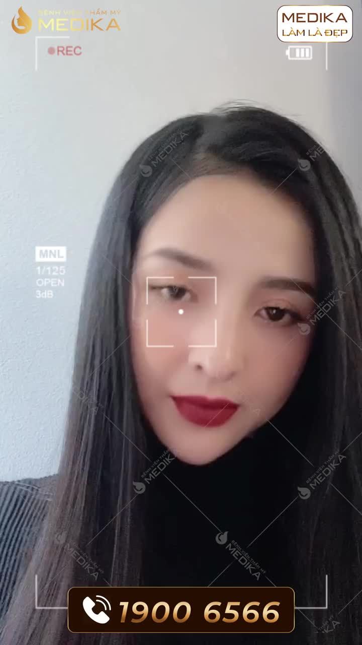 TẤM TẮC VỚI DÁNG MŨI ĐẸP XUẤT SẮC CỦA PHƯƠNG THẢO