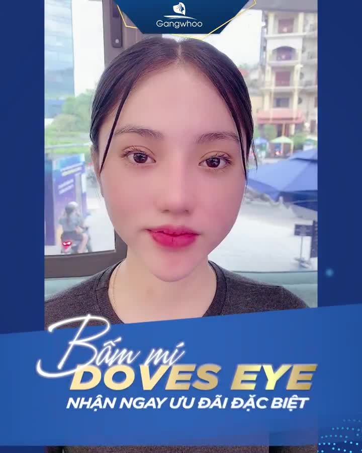 VÉN MÀN TIN ĐỒN VỀ BẤM MÍ DOVE EYES…