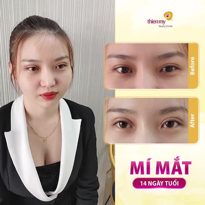 HÌNH NHƯ EM BỊ CẢM RỒI...CẢM THẤY MÍ MỚI QUÁ ĐẸP