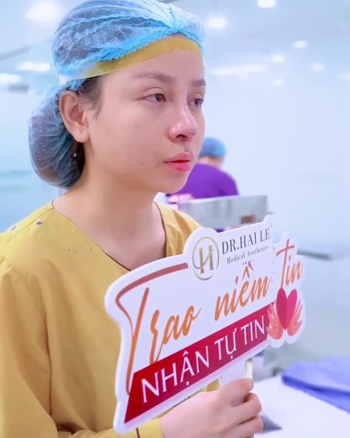 Mũi lỗi hỏng được Dr.Hải Lê chỉnh hình thành công như thế nào? Theo dõi ngay