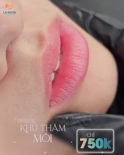 CHẤN ĐỘNG LA RATIO ƯU ĐÃI KHỬ THÂM MÔI chỉ 750K!