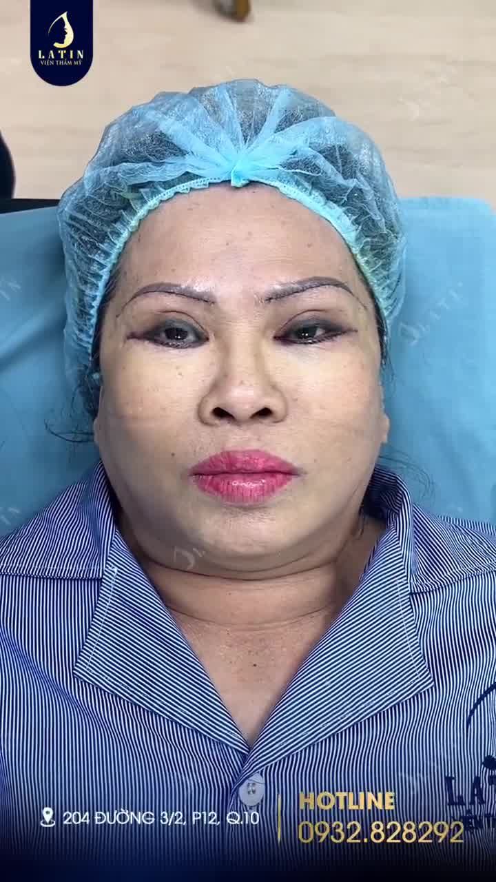 2 tiếng trẻ hoá tức thì cho cô khách 60 tuổi nhà Latin
