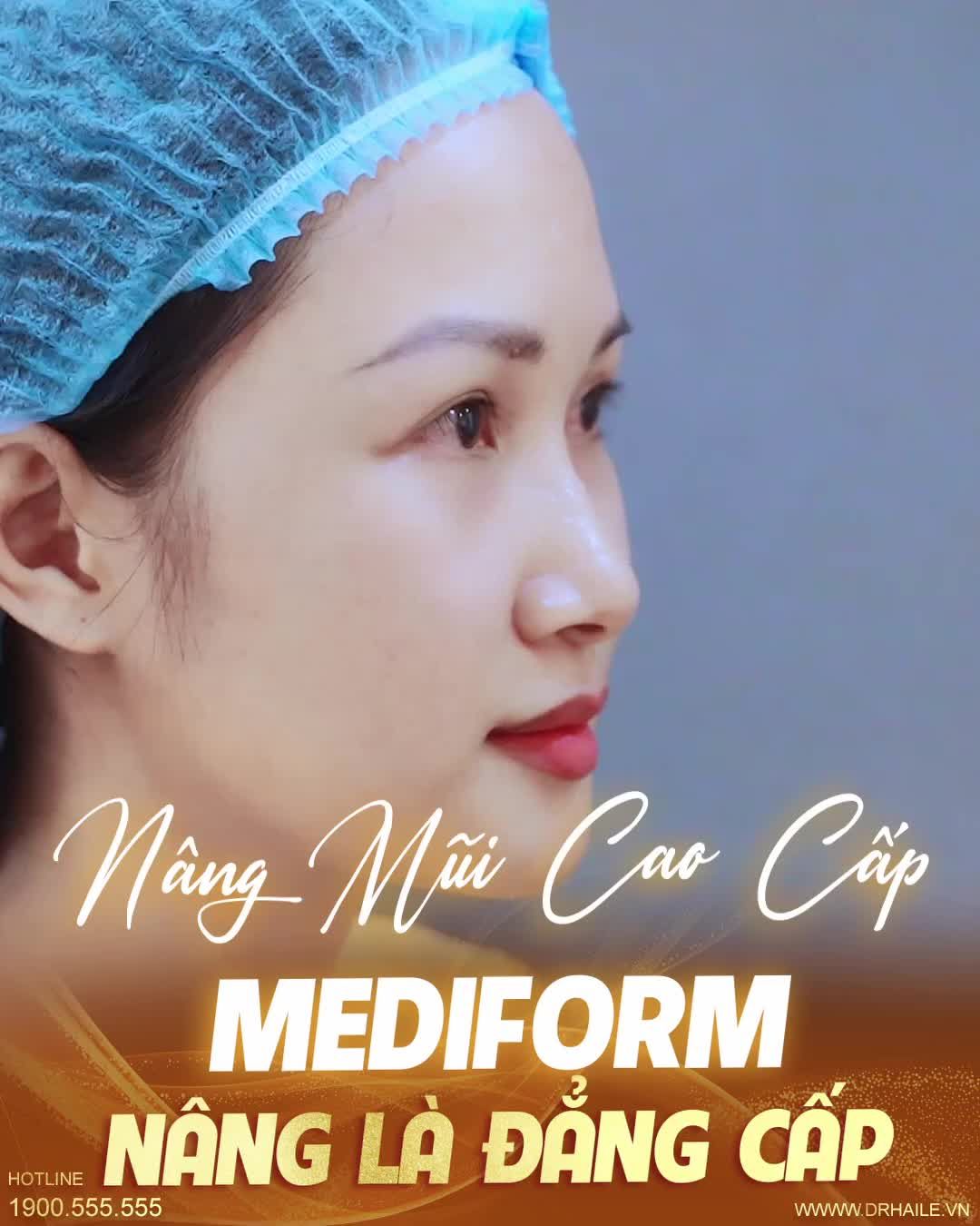 Nâng mũi Dr.Hải Lê – Đẹp sang không sến