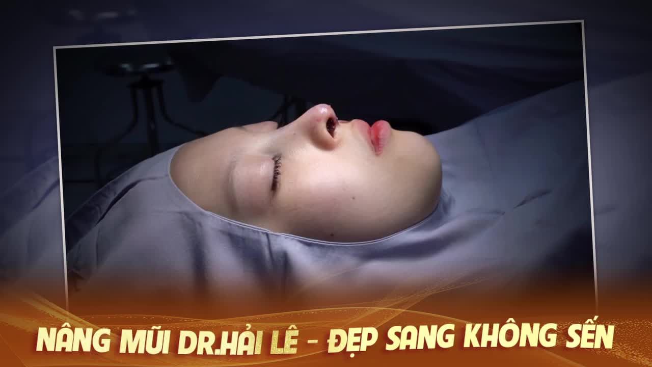 Khách hàng nâng mũi tại Dr Hải Lê