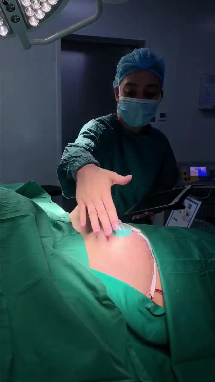 CA SA TRỄ PHÌ ĐẠI VỪA ĐƯỢC THỰC HIỆN BỞI EKIP DR. MINH PHẠM