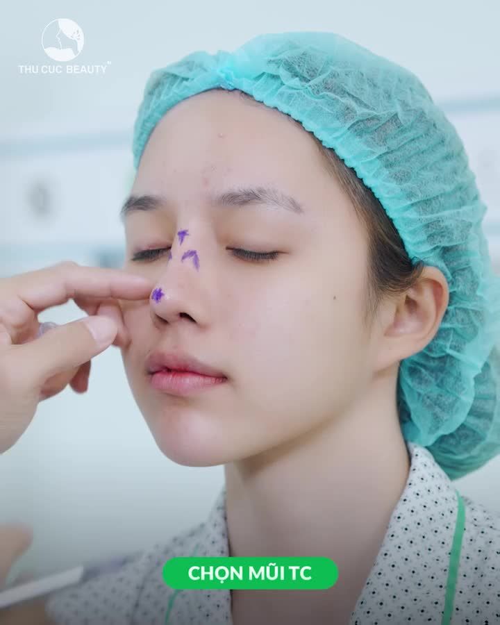 Chọn mũi Thu Cúc đẹp ngay sau làm