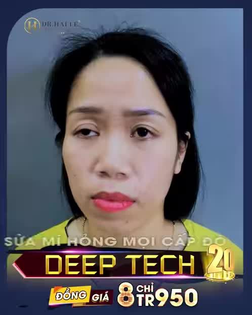 GIẢI CỨU MÍ LỖI HỎNG CHO KHÁCH HÀNG