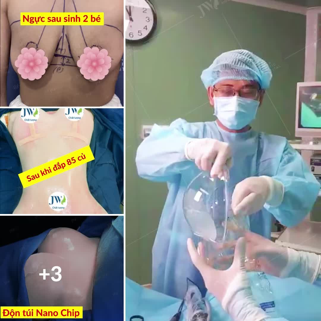 SIÊU PHẨM VÒNG 1 CĂNG TRÒN - ĐẦY ĐẶN cho Mẹ bỉm, BÍ QUYẾT GIỮ LỬA HẠNH PHÚC