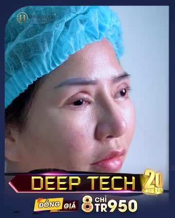 BẠN ĐÃ KHÔNG NGHE NHẦM: NHÂN THÁNG KỶ NIỆM 5 NĂM RA MẮT CÔNG NGHỆ DEEPTECH20 - GIẢI CỨU MỌI CA MÍ LỖI HỎNG TỪ NẶNG ĐẾN RẤT NẶNG