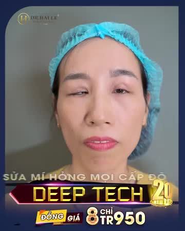 GIẢI CỨU MỌI CA MÍ LỖI HỎNG  NẶNG CHO KHÁCH HÀNG