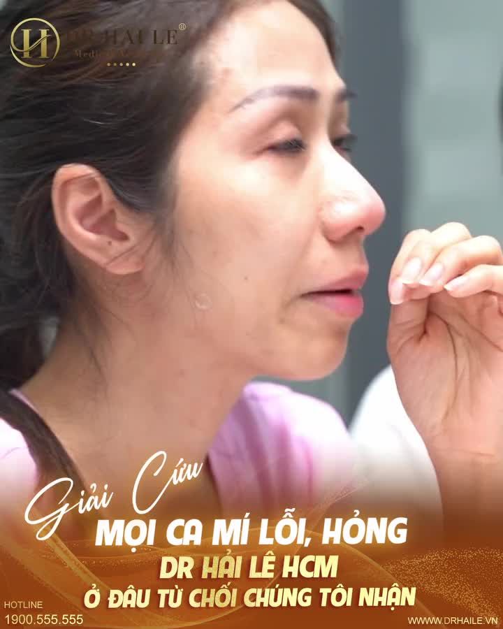 Dr.Hải Lê “giải cứu” mọi ca mí lỗi hỏng - ở đâu từ chối - chúng tôi nhận