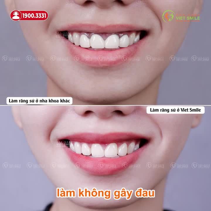 CHỌN NHA KHOA UY TÍN, CHỌN NỤ CƯỜI TỰ TIN