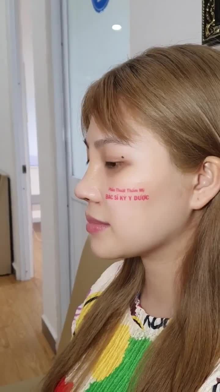 Nâng mũi ALINE Trong tháng 11 - giá chỉ từ 8,9tr.