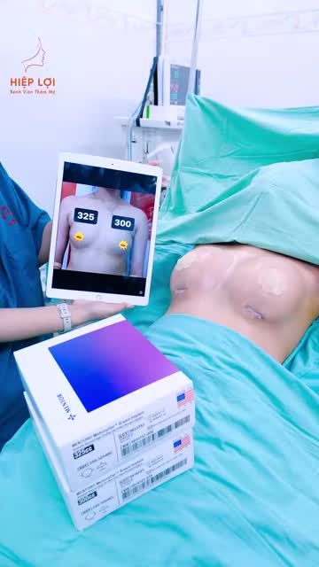 Ca nâng ngực sáng nay tại BVTM Hiệp Lợi cho khách hàng ngực nhỏ, ngực 2 bên không đều nhau.