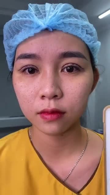 Bạn muốn sở hữu một đôi mắt hút hồn Đến ngay Dr.Hải Lê