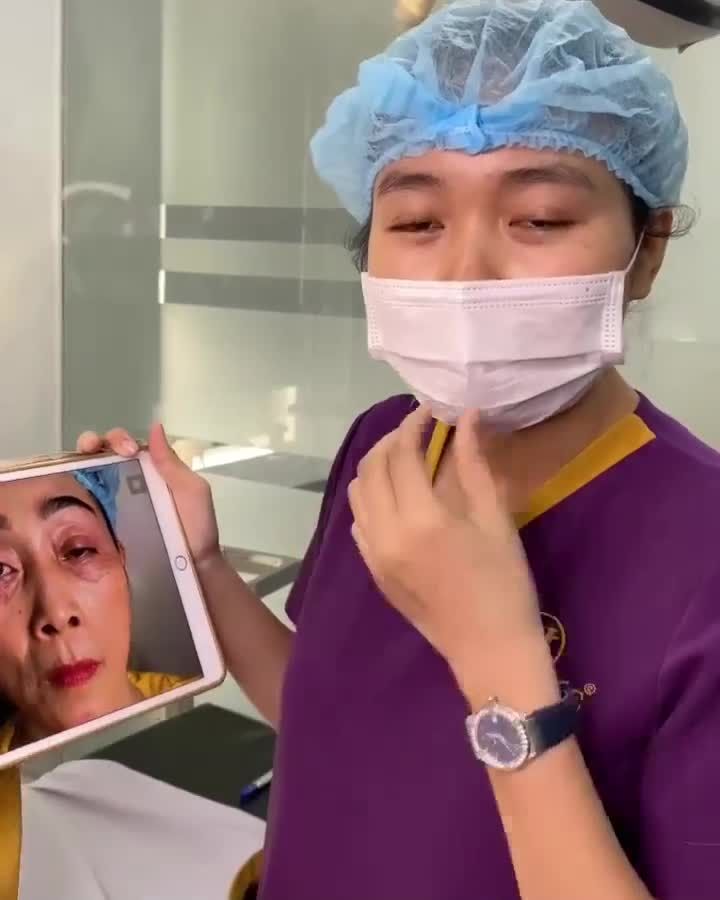 Mí lỗi hỏng nặng được Dr.Hải Lê Sài Gòn chỉnh hình thành công như thế nào? Theo dõi ngay