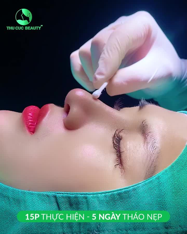 Mất bao lâu để mũi vào chuẩn form?