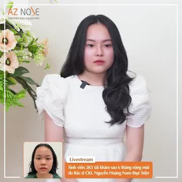 Sinh viên 2K5 tái khám sau 6 tháng nâng mũi cấu trúc, dáng Sline cao.
