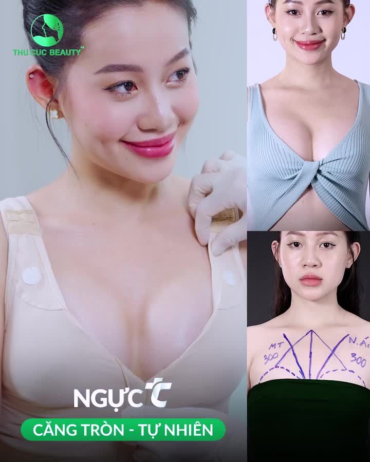Thẩm mỹ THu Cúc Nâng Ngực TC CĂNG MỀM, TỰ NHIÊN