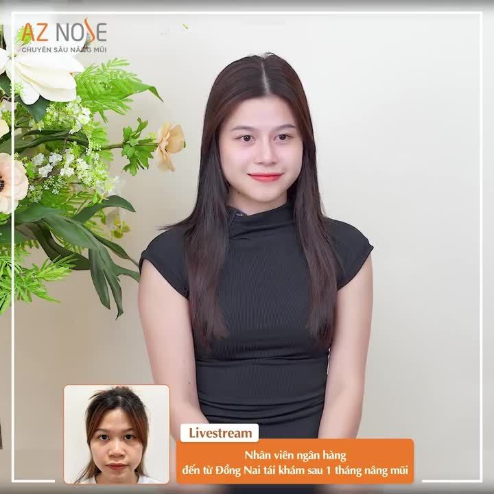 Nhân viên ngân hàng đến từ Đồng Nai chia sẻ cảm nhận sau 1 tháng nâng mũi do Bác sĩ CKI. Hoàng Nhung thực hiện