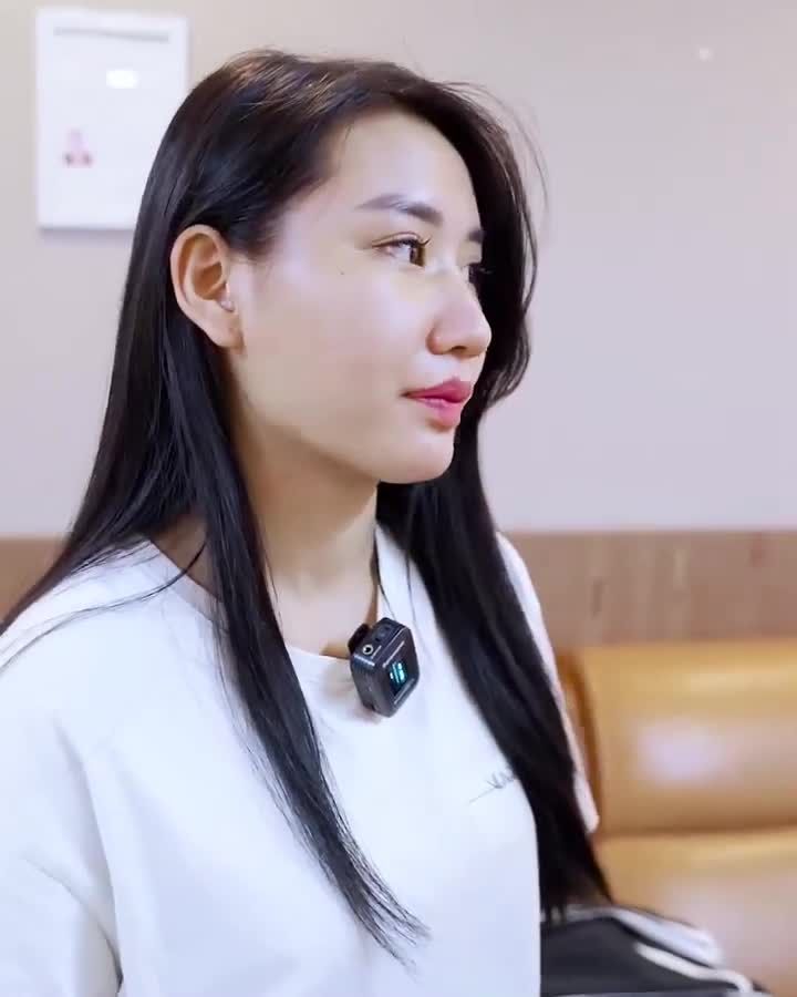 Chỉ sau 10 ngày nâng mũi đã giảm sưng và form mũi đã khá xinh rồi cả nhà ơi