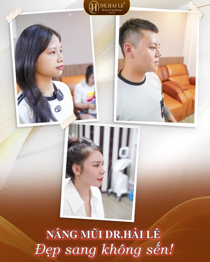 Đến Dr.Hải Lê, bạn sẽ nhận được tư vấn tận tình từ bác sĩ về dáng mũi phù hợp với bản thân - Đảm bảo thực hiện xong dáng mũi ưng ý, đẹp như mong đợi!