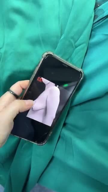 CA NGỰC SA TRỄ ĐỘ 4 ĐÃ CÓ KẾT QUẢ!