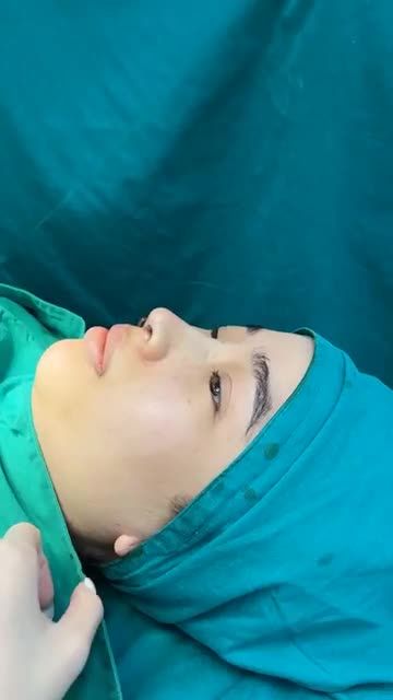 Case mũi cấu trúc vừa hoàn thành
