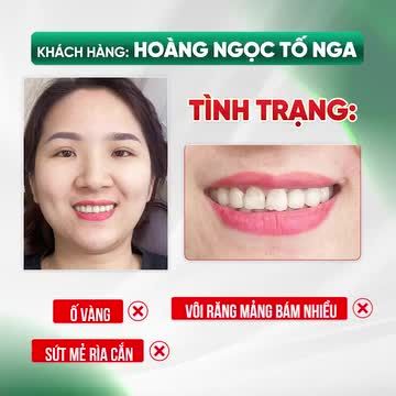 CHỊ GÁI CAO BẰNG TỰ TIN KHOE DIỆN MẠO NỤ CƯỜI MỚI