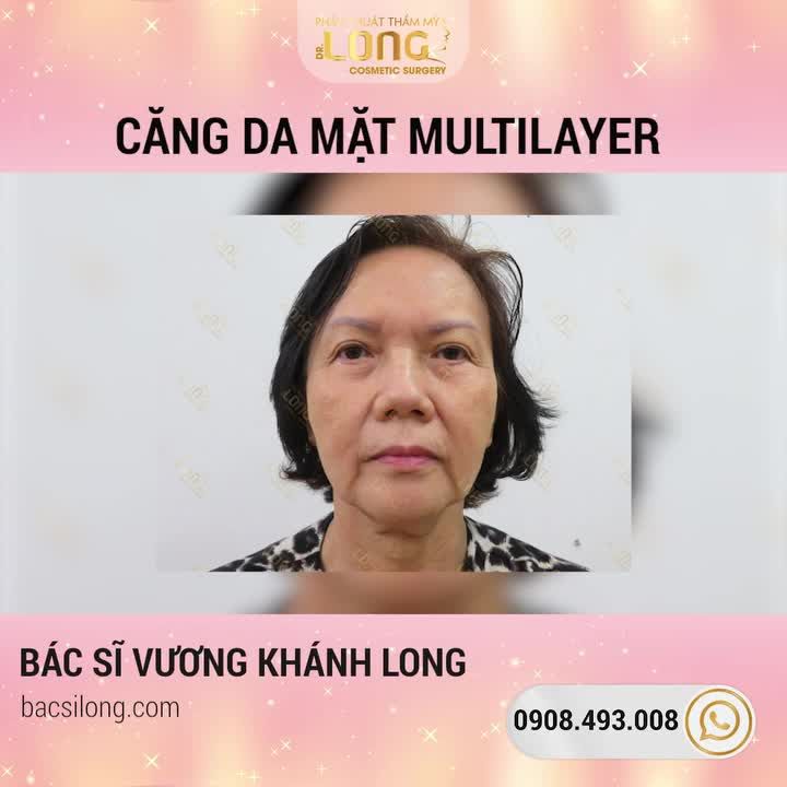GIẢI MÃ LÀN DA - KHUÔN MẶT TRẺ RA 10 TUỔI