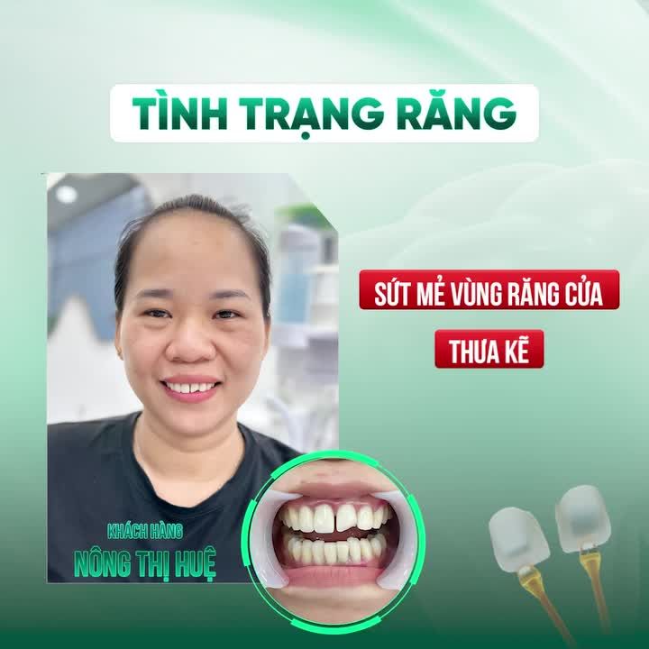 "LÀM RĂNG SỨ PHẢI CHỌN BÁC SĨ NHA KHOA GIA ĐÌNH MỚI YÊN TÂM"